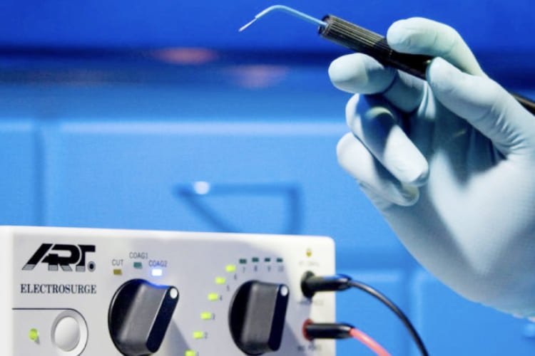 Electrocirugía cervical