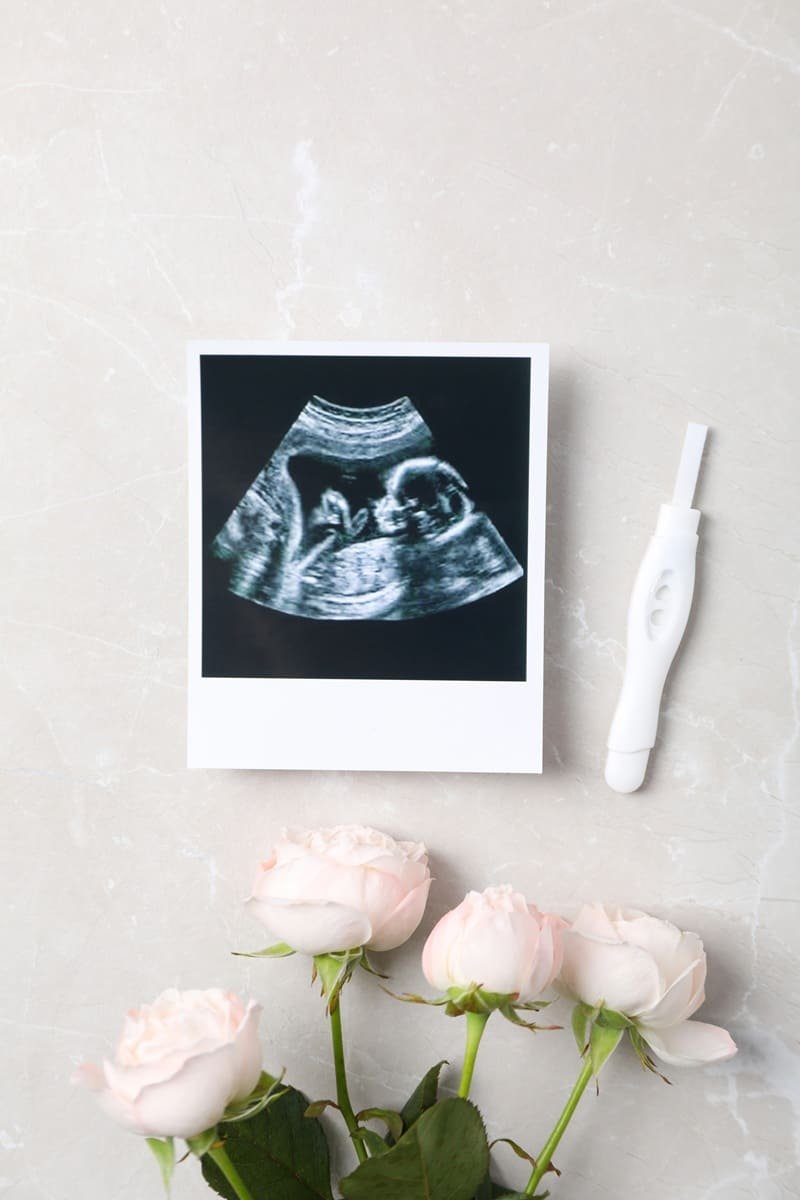 Atención de obstetricia en Querétaro